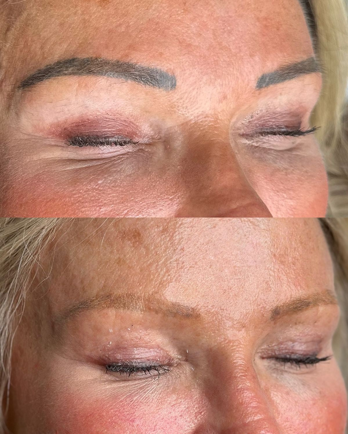 Removal | Permanent Makeup