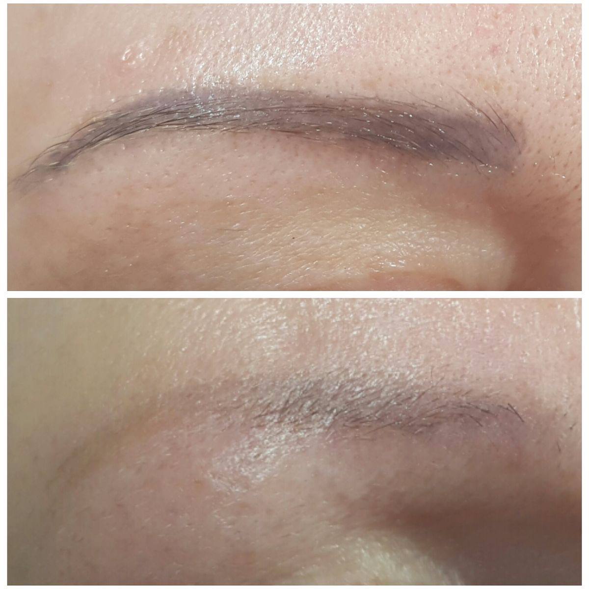Removal | Permanent Makeup